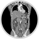 CT scan Icon