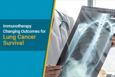 Immunotherapy for Lung Cancer: What it is & Success Rate | Mesothelioma