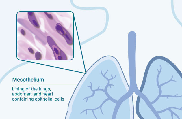 Sarcomatoid Cell Type