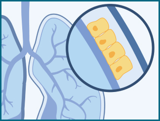 Epithelial cells line the thin membrane just outside of the lung cavity, abdominal cavity and heart