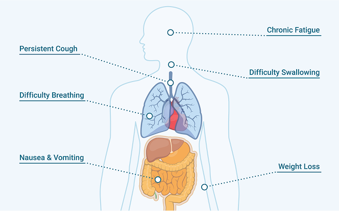 Visual representation of the human body and its organs, focusing on common symptoms of mesothelioma.