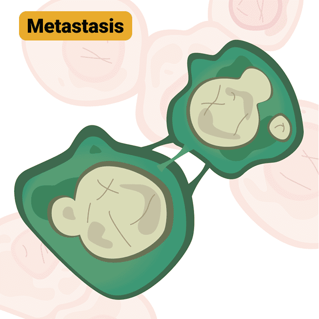 Diagram illustrating the TNM system for classifying cancer metastasis and the growth of cancer cells.