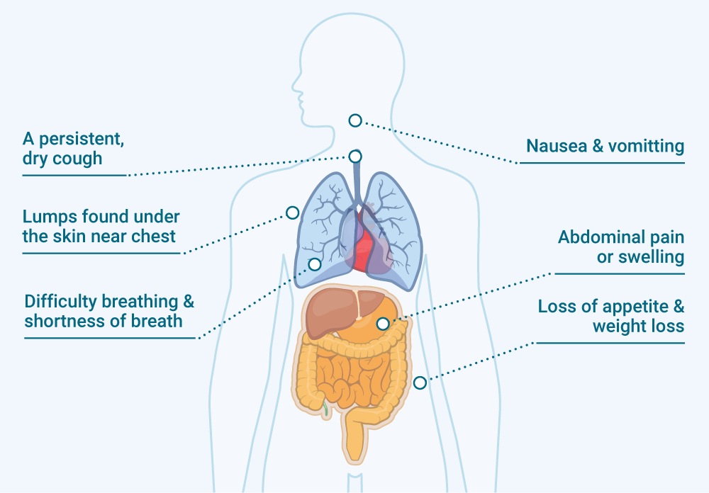 Visual representation of the human body and its organs, focusing on common symptoms of mesothelioma.