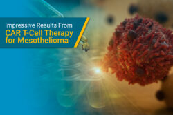 CAR T cells against mesothelioma in clinical trial
