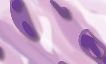 Sarcomatoid mesothelioma tumor cells