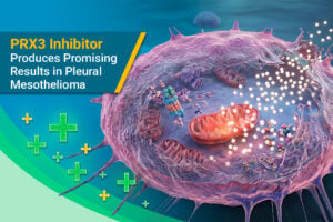 PRX3 Inhibitor Produces Promising Results in Pleural Mesothelioma