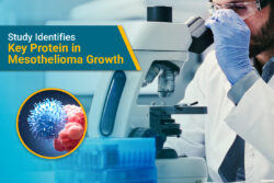 A team of cancer researchers at the Aichi Cancer Center Research Institute in Nagoya, Japan have identified a key protein that causes the growth and proliferation of mesothelioma cells,