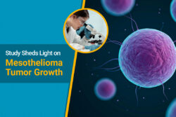 A team of researchers from the University of Hawaii Cancer Center published a study last week sharing new findings on how the protein known as HMGB1 helps mesothelioma cells grow and proliferate, potentially shedding more light on the exact mechanisms driving the deadly cancer.